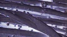 Mikroskopický snímek roztočů v lůžku
